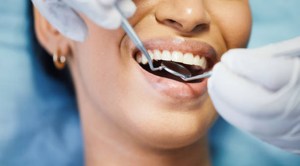 Best Emergency Dental Extractions in Baltic, CT
